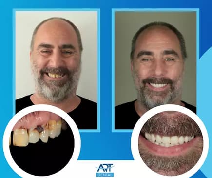 Slider image (2) Art Dental Care